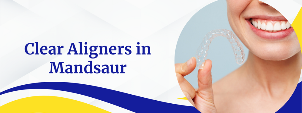 Clear Aligners in Mandsaur Clear Aligners in Mandsaur